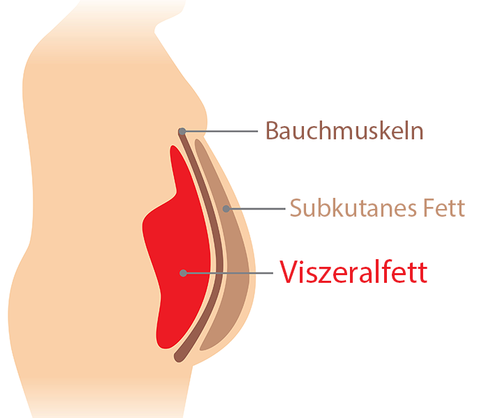 grafik_bauchfett